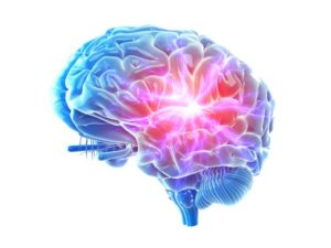 3d Rendered Illustration Of A Painful Brain.